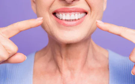Teeth Whitening in Dubai: Step-by-Step Treatment Guide