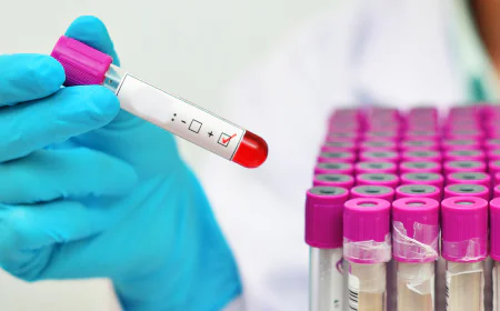 HIV Testing : What to Expect During Screening