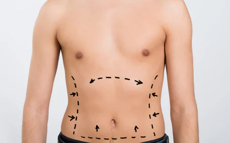 SmartLipo vs Laser Liposuction: Key Differences Explained