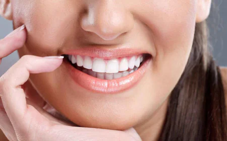 Complete Guide to Teeth Whitening in Dubai