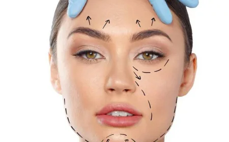 Brow Lift for Drooping Eyebrows Explained