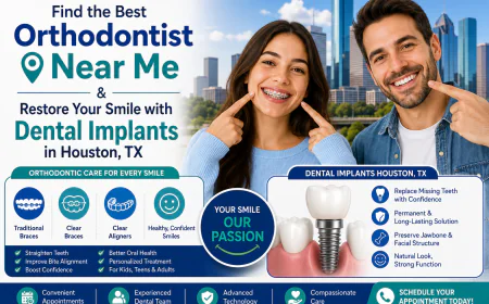 Find the Best Orthodontist Near Me & Restore Your Smile with Dental Implants in Houston, TX
