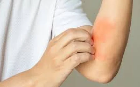 Fungal vs. Bacterial Skin Infection: What's the Difference?
