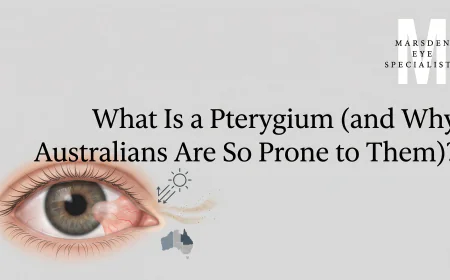 What Is a Pterygium (and Why Australians Are So Prone to Them)?