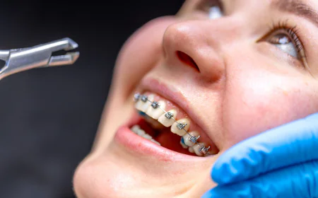 Fast Braces & Adult Orthodontic Care in League City: Get the Smile You’ve Always Wanted