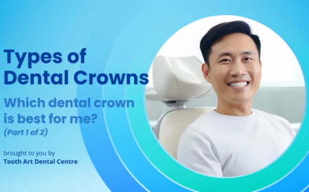 Types of Dental Crowns: Which Dental Crown Is Best For Me?
