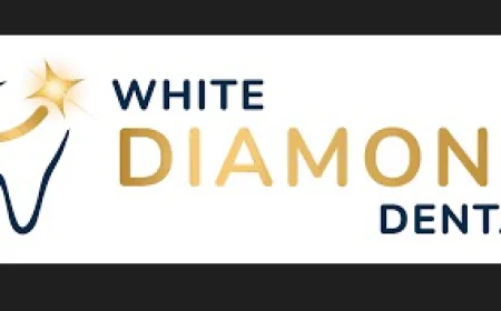 Teeth Whitening Services in Monument CO: Professional Solutions for a Brighter Smile