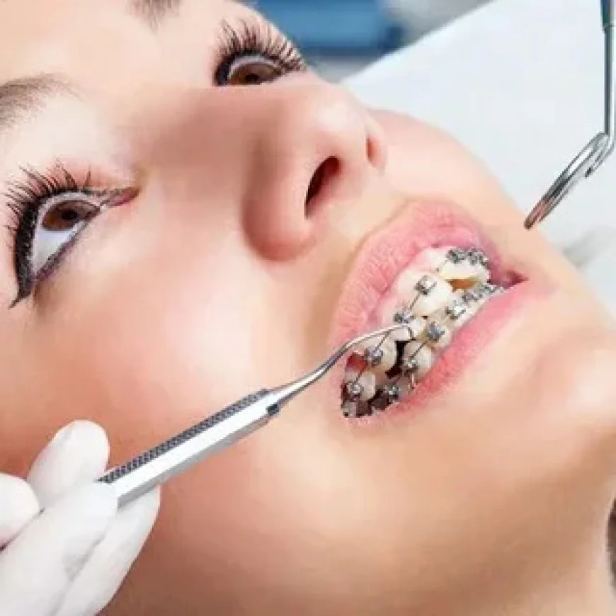 Fractured Teeth Treatment in Islamabad – Restore Your Smile Effectively