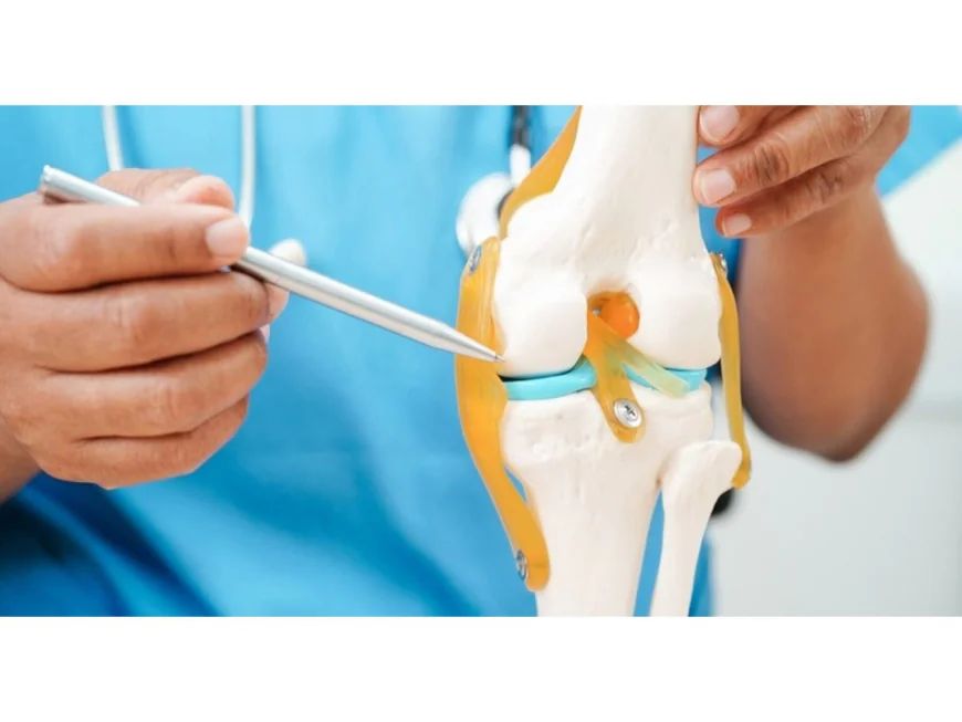 Knee Replacement Side Effects: Risks You Must Know Before Surgery