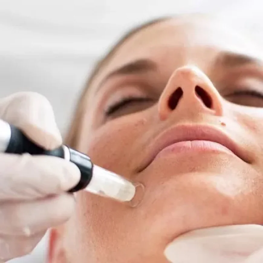 Skin Pigmentation in Islamabad at Enfeild Royal Clinic