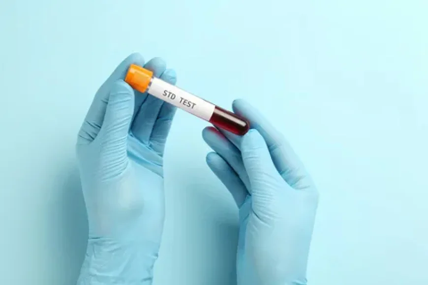 STD Test in Dubai: A Comprehensive Guide to Modern Diagnostics