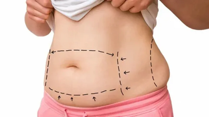 Best Tummy Tuck Dubai: Advanced Body Contouring Procedures