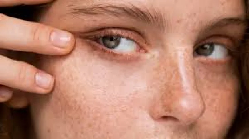 How Pigmentation Removal Addresses Sun Damage