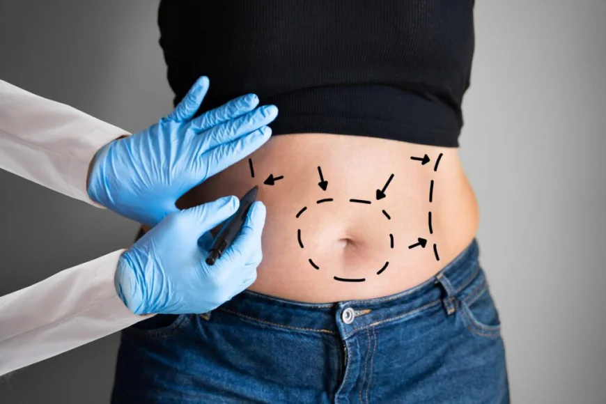 Who Is a Good Candidate for a Tummy Tuck?