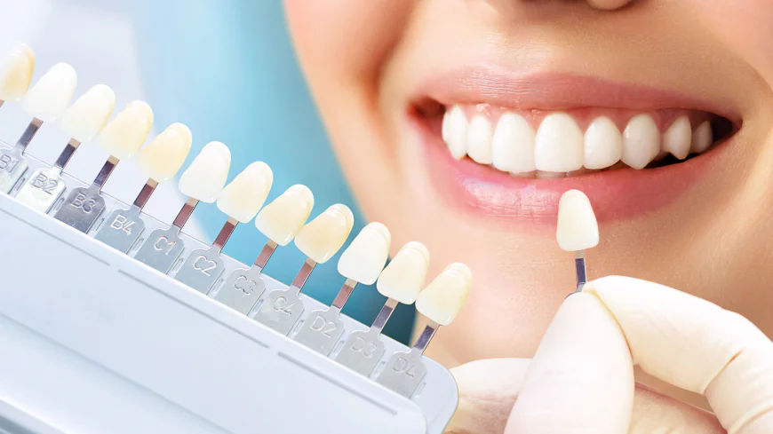 Teeth Cleaning Dubai Cost and Complete Dental Guide