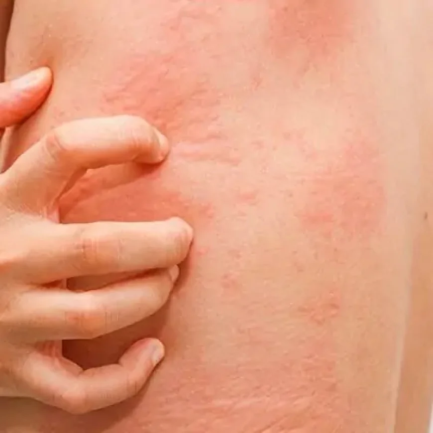 Can Skin Diseases Be Treated Effectively?