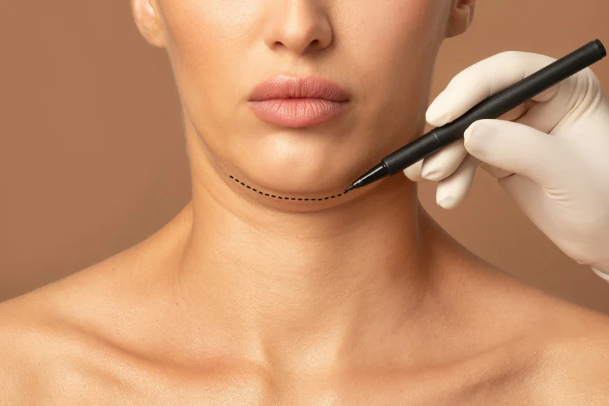 Can Double Chin Liposuction Be Performed on Younger Patients?