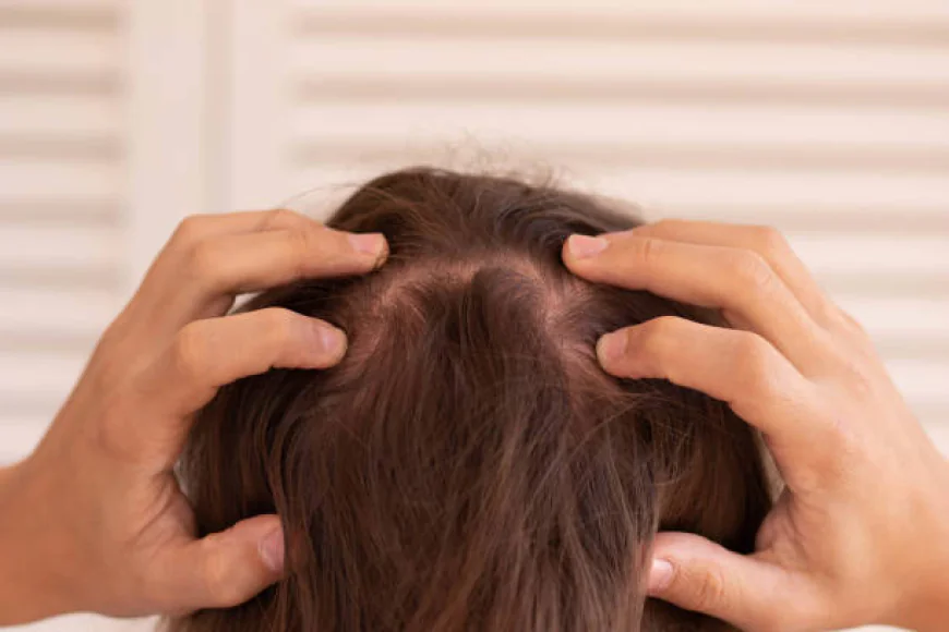 Advanced Solutions for Hair Thinning and Baldness Recovery