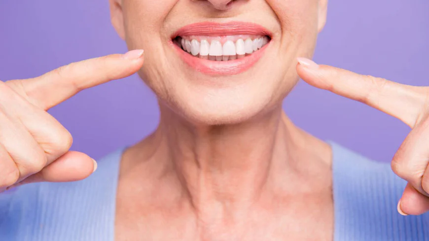 Teeth Whitening in Dubai: Step-by-Step Treatment Guide