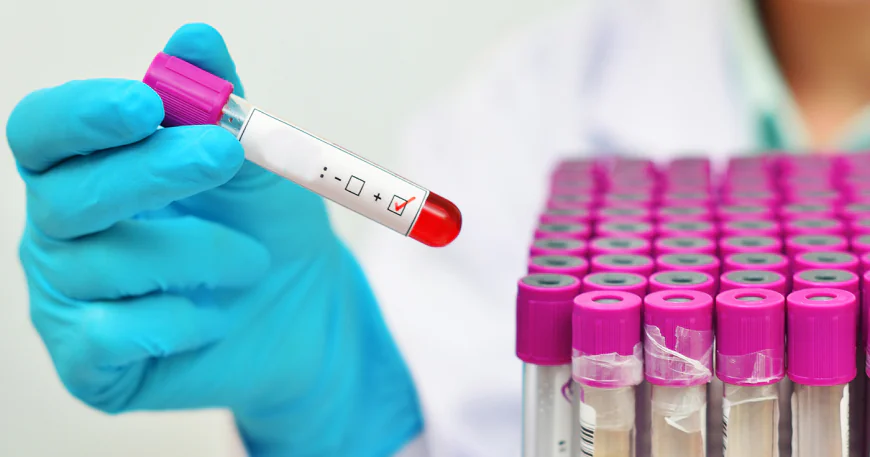 HIV Testing : What to Expect During Screening