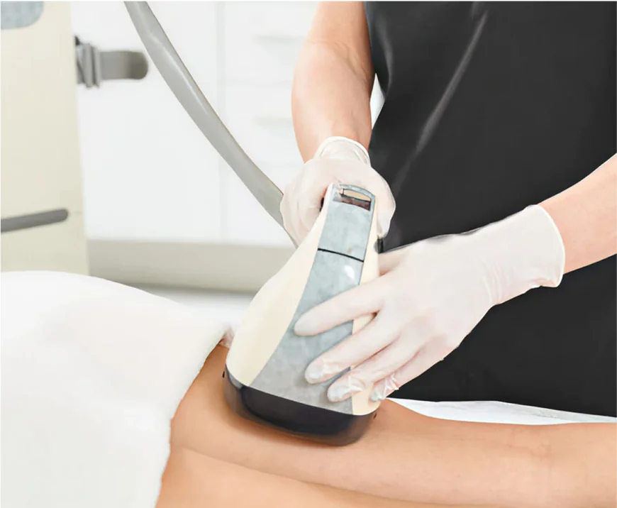 How Does Velashape 3 Help Reduce Cellulite?