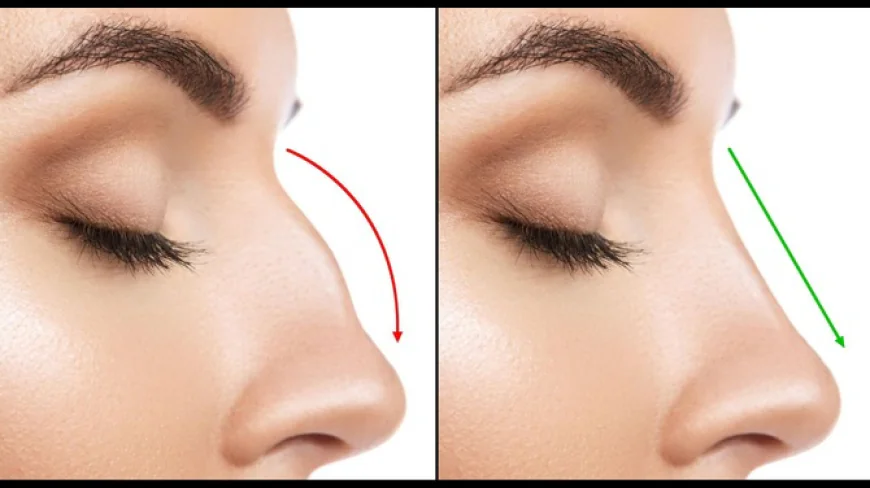 Rhinoplasty in Dubai: Advanced Nose Reshaping for Facial Harmony and Confidence