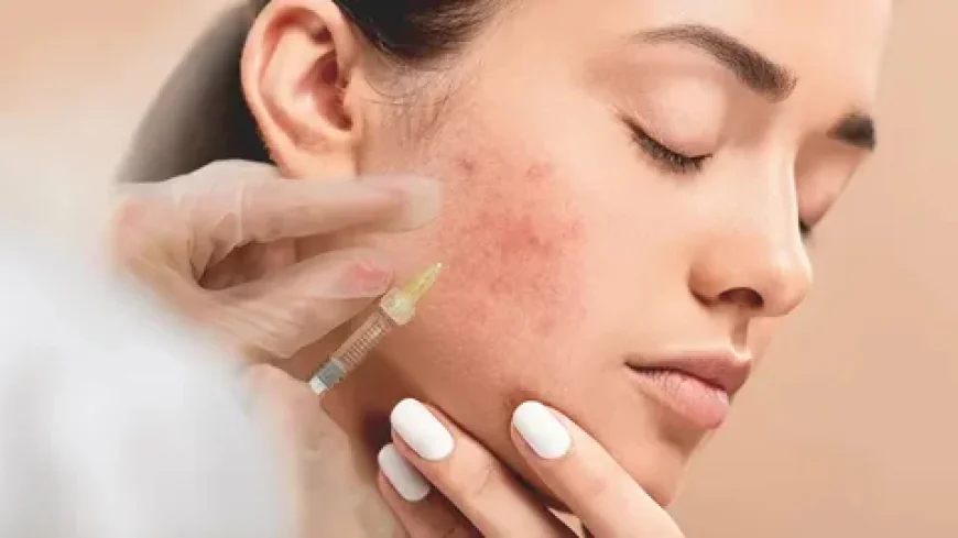 Safe Pimples Treatment in Dubai: Transforming Your Skin