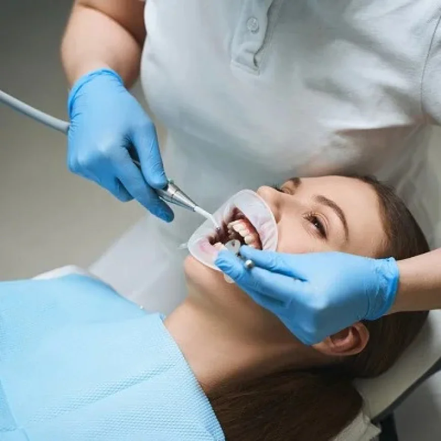 Teeth Filling in Islamabad – Enfeild Royal Clinic in Islamabad