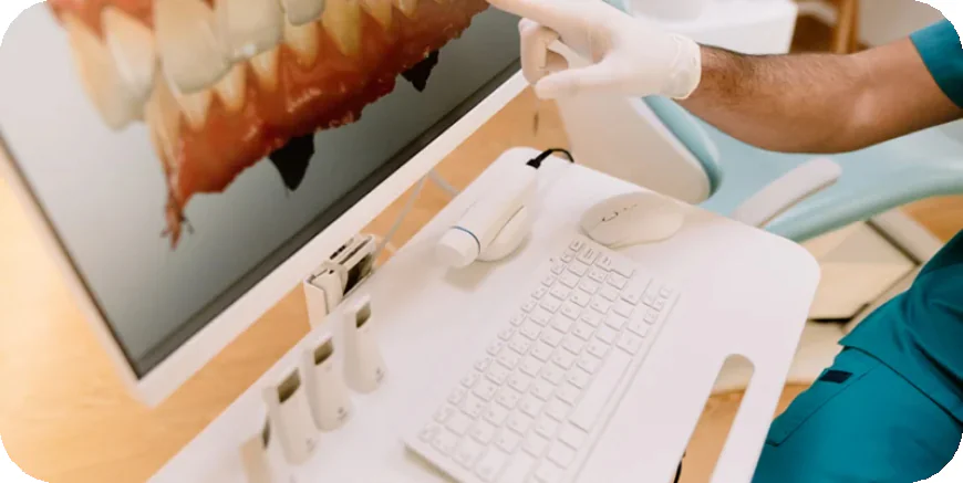 Tooth Replacement Broome County: Restore Your Smile with Modern Dental Solutions