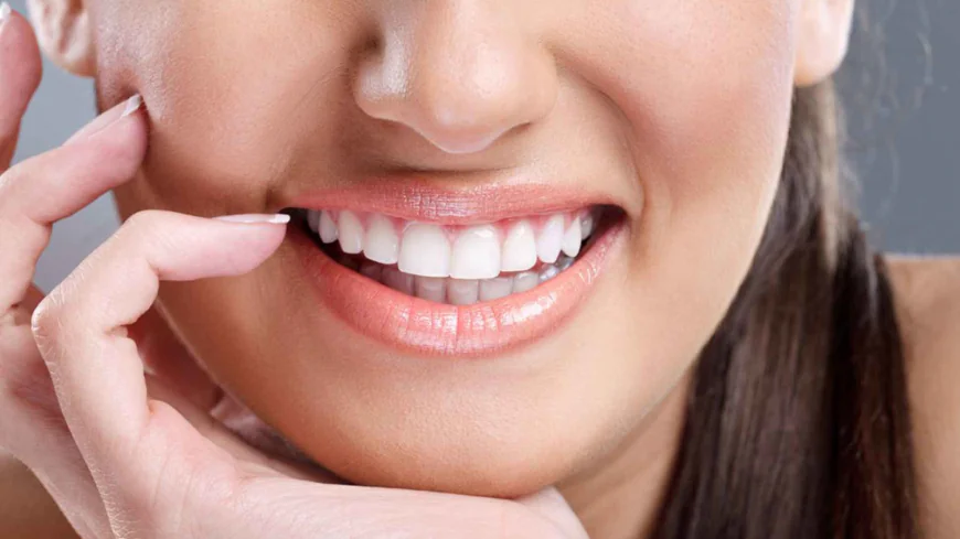 Complete Guide to Teeth Whitening in Dubai