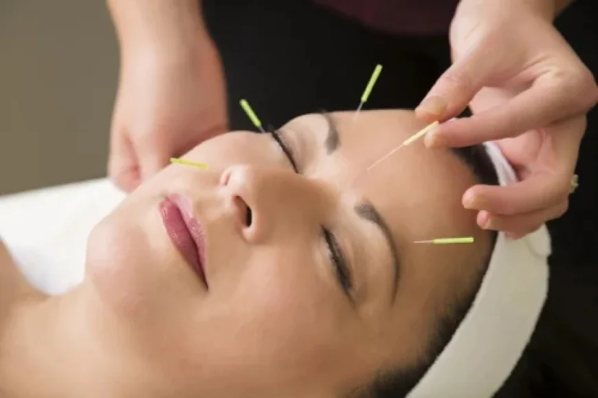 Why Choose Cosmetic Acupuncture in San Francisco for Skin Health