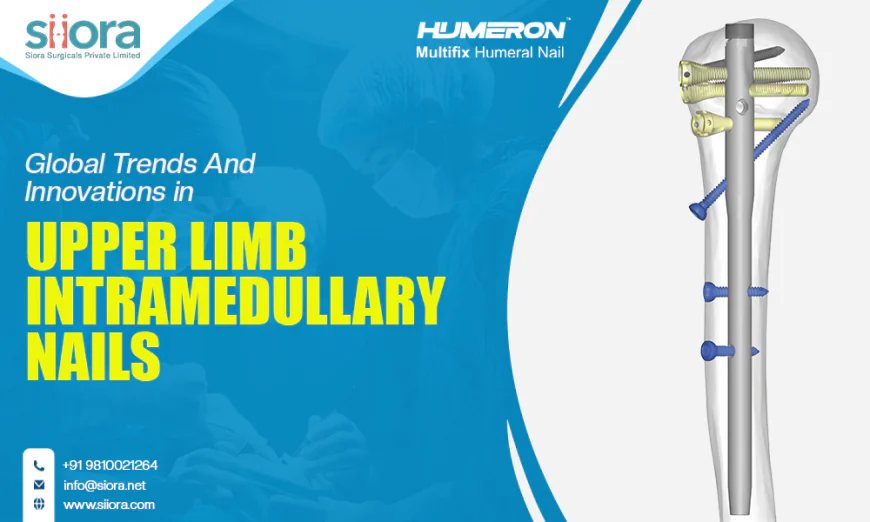 Global Trends & Innovations in Upper Limb Intramedullary Nails