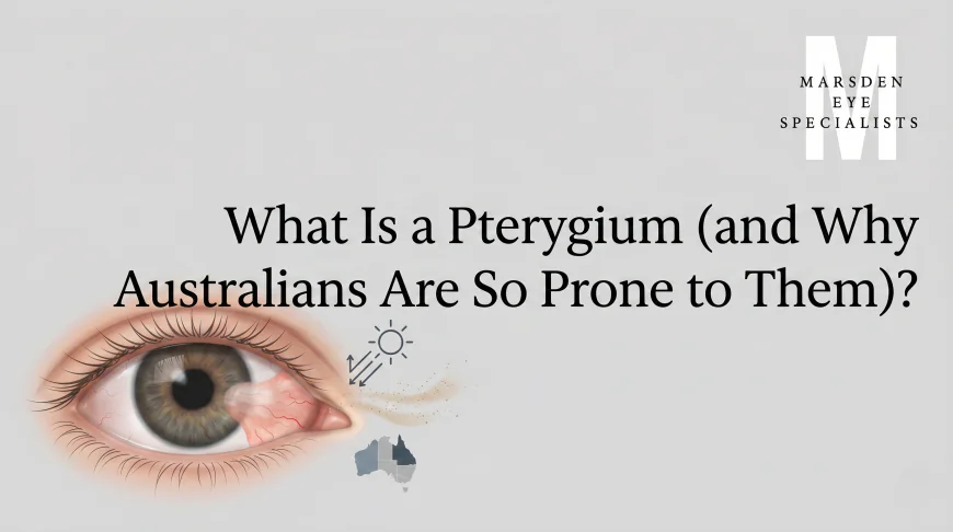 What Is a Pterygium (and Why Australians Are So Prone to Them)?