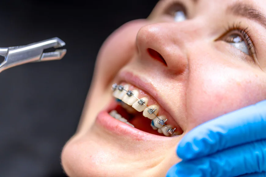 Fast Braces & Adult Orthodontic Care in League City: Get the Smile You’ve Always Wanted