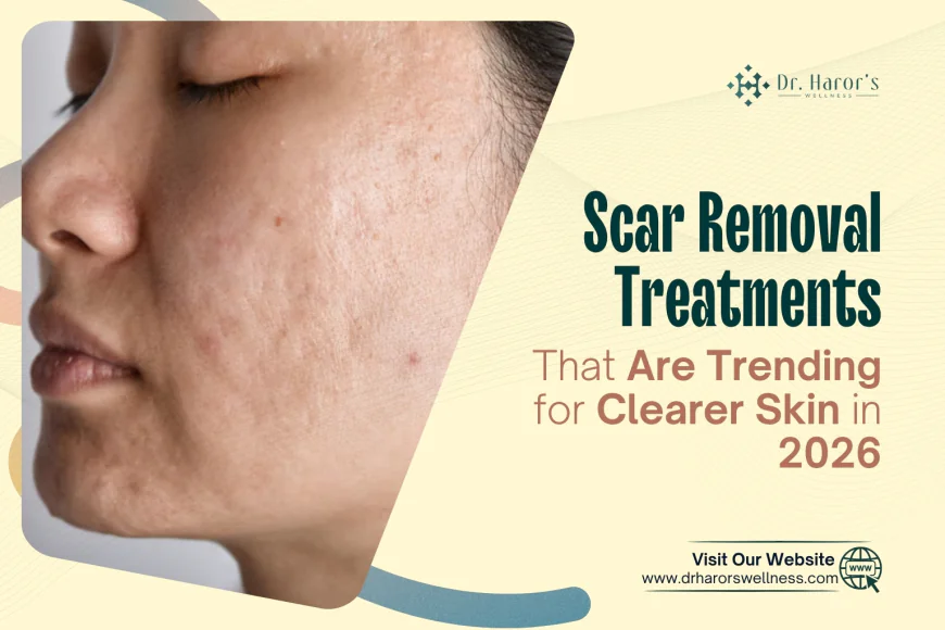 Scar Removal Treatments That Are Trending for Clearer Skin in 2026