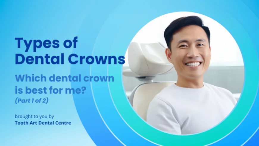 Types of Dental Crowns: Which Dental Crown Is Best For Me?