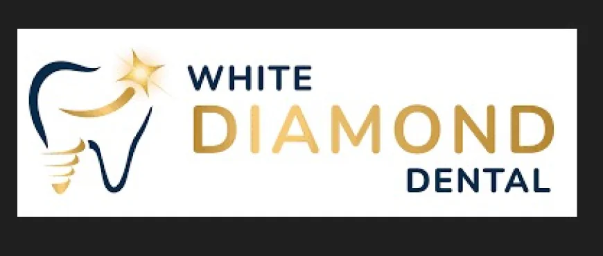Teeth Whitening Services in Monument CO: Professional Solutions for a Brighter Smile