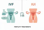 IVF vs IUI: Which Fertility Treatment Is Right for You?