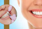 How to Choose the Right Cosmetic Dentist for Treatment