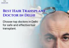 Choosing the Right Hair Transplant Surgeon in Delhi: A Simple Guide for Patients