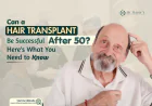 Can a Hair Transplant Be Successful After 50? Here’s What You Need to Know