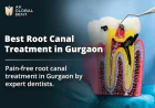 Get Pain-Free Root Canal Treatment at Gurgaon's Leading Dental Clinic