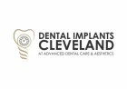 Why Dental Implants Are the Best Long-Term Solution for Missing Teeth?