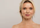 Can HIFU Treatment Effectively Reduce Deep Forehead Wrinkles Fast