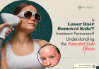 Is Laser Hair Removal Safe? Understanding the Potential Side Effects