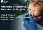 Best Orthodontic Treatment in Gurgaon - Get Your Perfect Smile at AK Global Dent