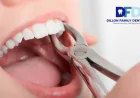 How Painful Is a Tooth Extraction? Bryn Mawr Dentist Guide
