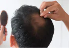 Effective Hair Loss Treatment in Beverly Hills, CA: Your Guide to Restoring Confidence