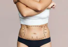 Understanding How Pregnancy Can Change the Abdominal Area
