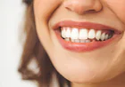 Teeth Whitening Dubai Best Whitening Techniques